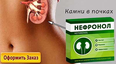 Нефронол можно купить по привлекательной цене